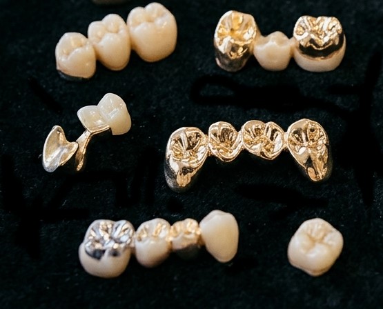 Zahngold verkaufen Zahngold wie Kronen und Brücken auf einem Samttuch